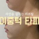 온스킨