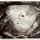 전앤부침개 | 임신일기2] 임신 극초기 4주차 증상과 일상/ 일상유희 초음파앨범, 젤리캣 바쉬풀 블랙 앤 크림 퍼피