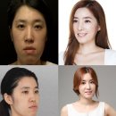 렛미인 이미지