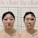 케어라인일렉스타 | 전주 리디안에스테틱 두골비 관리 후기 *아프지 않은 케어로 전주비대칭윤곽관리 추천*