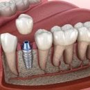 바른임플러스치과의원 이미지