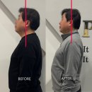 파라드시티 | 광주광역시 상무지구 파라드 시티 체형교정 후기