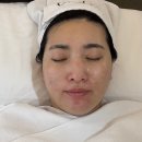 [수완지구 피부관리] 꼬모에스테틱 : 여름과 홍조 해결! 시그니처 리턴 케어 후기
