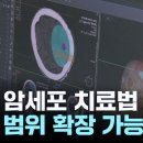 뇌종양 '교모세포종'이 이제는 완치까지 내다볼 수 있게 됐습니다. 이미지