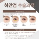 미본 이미지