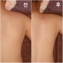 라인현대천호 네이버블로그