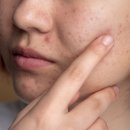 여울스킨케어 이미지