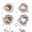 KN메디컬 이미지