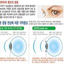안경매니져 첨단산월점 네이버블로그