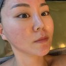 양유나 스킨테라피 | 양재역피부관리 양유나스킨테라피 수분케어 후기
