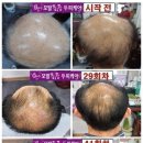 큐사랑 이미지