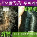 케어큐 이미지