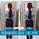 바른체형척추관리 이미지