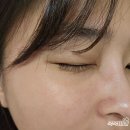 재생크림 더마에스씨 센텔라스카 시카 나비존 요철크림