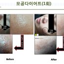 진피부샵 이미지