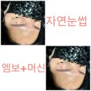 미인에스테틱 네이버블로그