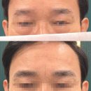 남구-67 | 울산 눈썹 합법화를 위한 미리 준비 남구 반영구 교육학원 라즐라