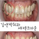 투명한 치과기공소 이미지