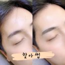307눈썹