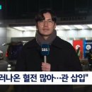 [속보] 이재명 &#34;내경정맥 60% 손상.. 혈관 재건 수술&#34; 이미지