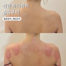 천안체형관리 솜솜뷰티 에너지테라피 승모근 웨딩관리 추천