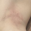씨씨즈왁싱 | [부천 심곡동] 선생님… 또 갈게요… 브라질리언왁싱은 부천역 씨씨즈 왁싱