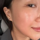 김포한강11로 | 김포피부관리 운양동 김기옥스킨케어 건조피부 후기