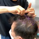 대구 달서구 상인동 미용실 링거펌 탈모펌 후기