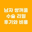 남자 쌍꺼풀 수술 리얼 후기! 자연스러운 눈매와 비용까지 정리