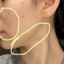 청담안즈피부과의원 이미지