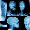 조은오산병원 이미지