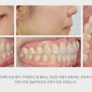 고운미소치과의원 이미지