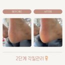 네일트위