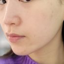 김포 풍무동 피부관리 고운결 에스테틱 관리 후기