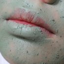 미세먼지로부터 피부관리 필수는 얼굴각질제거 + 파파레서피 클렌징타올 좋아요