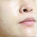 바이퓨어 이미지