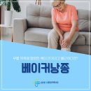 삼척역마취통증의학과 무릎 뒤쪽이 불룩하게 부어오른다면? 베이커낭종