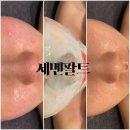 쏠뷰티스킨케어