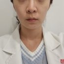 bbl 레이저 미백과 스킨타이트 리프팅을 한 번에! 후기