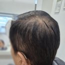 포낙보청기 김포센터 이미지