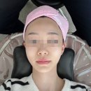 상동삼거리 | [경기/부천]부천 상동 피부관리 화이트 색소관리 써니뷰티 부천상동점에서 받고 왔어요 피부맞춤케어샵...