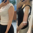 멍이가 웃통벗는날 | 강남에서 팔뚝 지방흡입 받은 지 2주 차! 지흡 후기(수술 당일부터 완전 자세함)