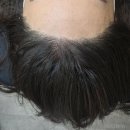 헤어, 그리고 사람 | 앞머리 비어보이던 이마… 천호헤어라인 하나로 사람이 달라진 리얼 후기 (자연스러움 미쳤어요)
