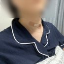 명일이비인후과의원 | 갑상선 세침검사 FNA 조직검사 비용, 물혹 3cm 제거, 갑상선 결절 후기