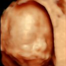 차박사 - 동대문구 고산자로 550 | [임신 21주차] 분당제일여성병원 2차 정밀초음파 후기👶 (배크기/한성식 박사님/입체초음파)