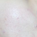 메디포엘 이미지