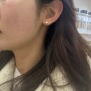 우리은행(익산지점) | [익산 창인동 피부샵]&#39;결뷰티&#39;에서 모공관리 받은 후기