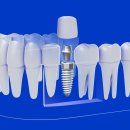 드림탑치과 이미지