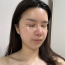 엘로우케어 | 광주 주월동 물빛스킨케어 LD소닉 관리, 얼굴붓기 윤곽 개선 내돈내산 후기