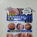 알미네일 이미지